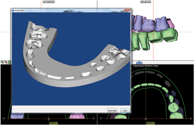 dolphin-imaging-3d-surgery-1